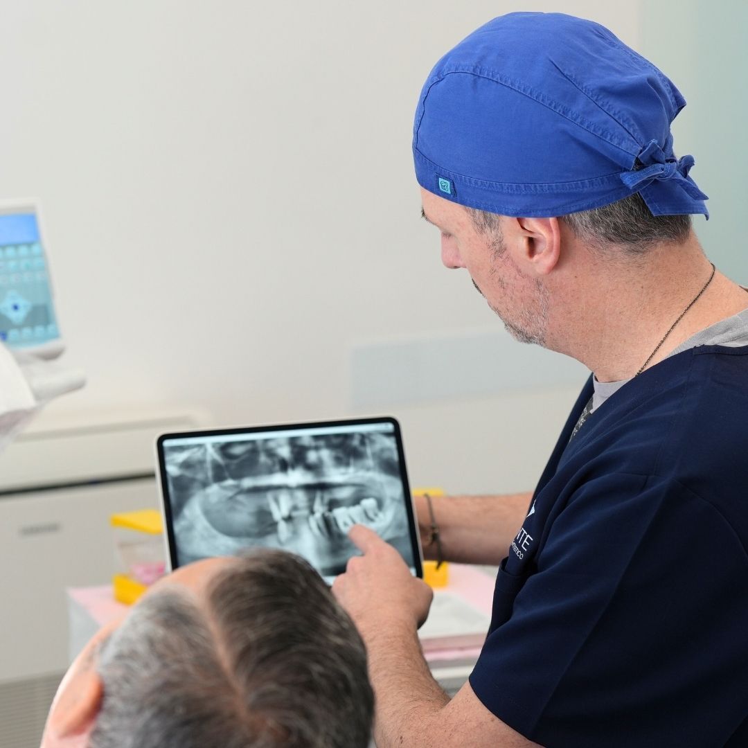 Implantes Dentários em Tarento: A Solução Definitiva para um Sorriso Radiante e Duradouro