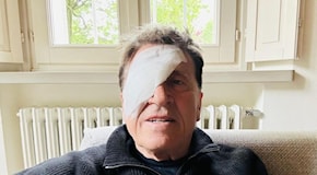 Gianni Morandi compare con una grossa benda sull'occhio. Fan preoccupati