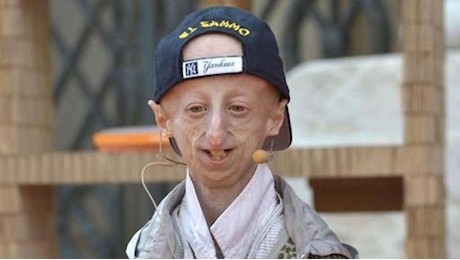 Progeria, che cos'è la malattia di cui soffriva Sammy Basso, come viene diagnostica, quali sono le cause e le cure