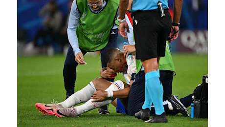 Mbappé, frattura al naso: dovrà essere operato