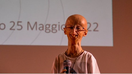 Cos'è la progeria, la rarissima malattia che ha colpito Sammy Basso morto a 28 anni