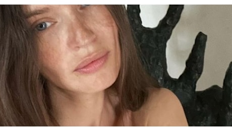 Bianca Balti, vistosa cicatrice dopo l'operazione: La foto più coraggiosa