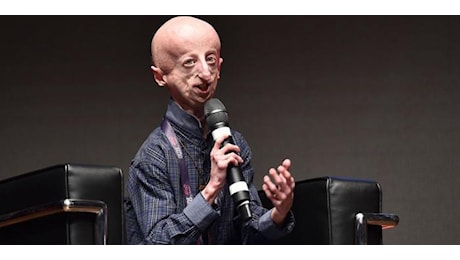 La morte di Sammy Basso: cos'e' la Progeria di Hutchinson-Gilford