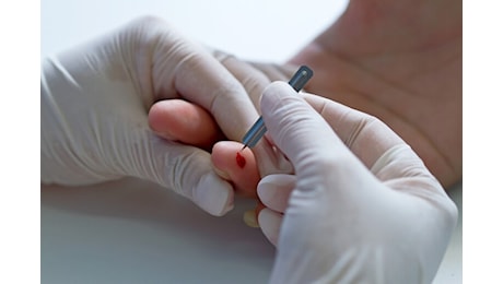 Scoperto un nuovo test del sangue per la diagnosi precoce del Parkinson. Come funziona