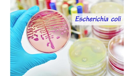 Escheria coli Olimpiadi, cos’è la pericolosa infezione: cause, sintomi, cure, diagnosi