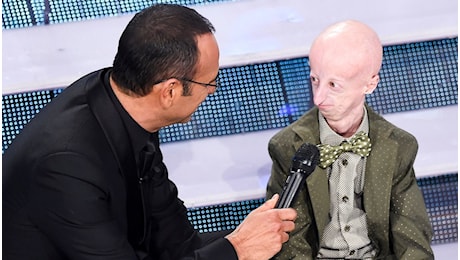 Morto Sammy Basso, a Sanremo nel 2015 aveva detto: “La mia forza è la positività”