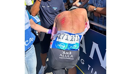 Renewi Tour 2024, brutta caduta all’arrivo per Tim Merlier e Dylan Groenewegen: per il belga, declassato dalla giuria, solo qualche abrasione (VIDEO)