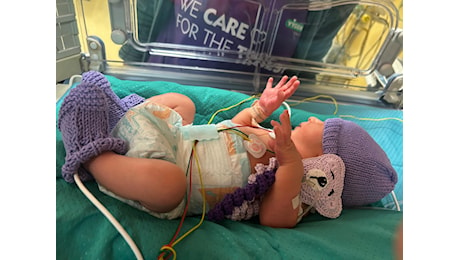 Giornata Mondiale della Prematurità, L’ARNAS Civico in prima linea per l’assistenza ai neonati